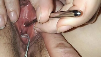 Urethral P...